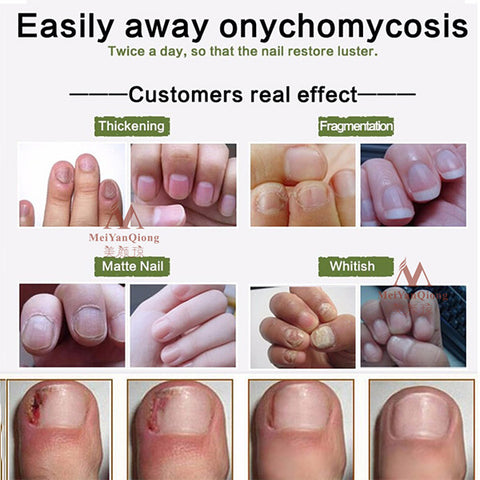 Nail Repair Cream Buy 1 Take 1