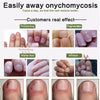Image of Nail Repair Cream Buy 1 Take 1